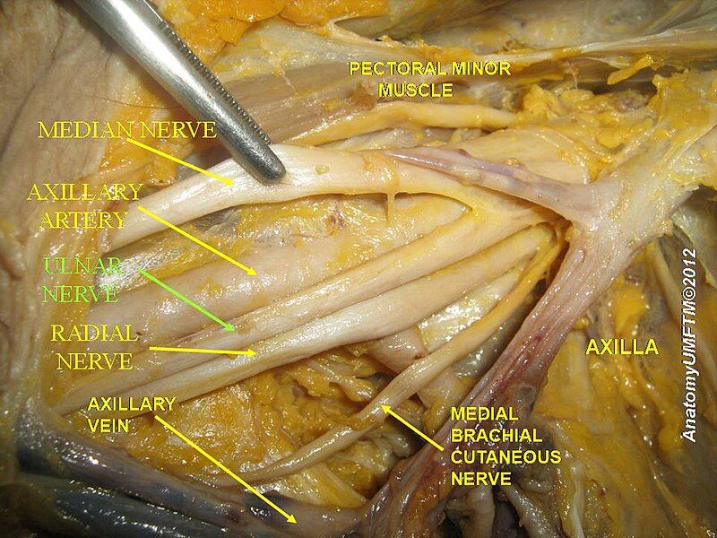 File:Slide3bbbb.JPG