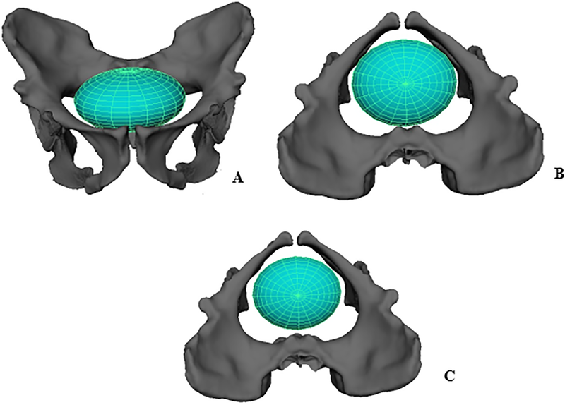 File:Australopithecus sediba birth.png