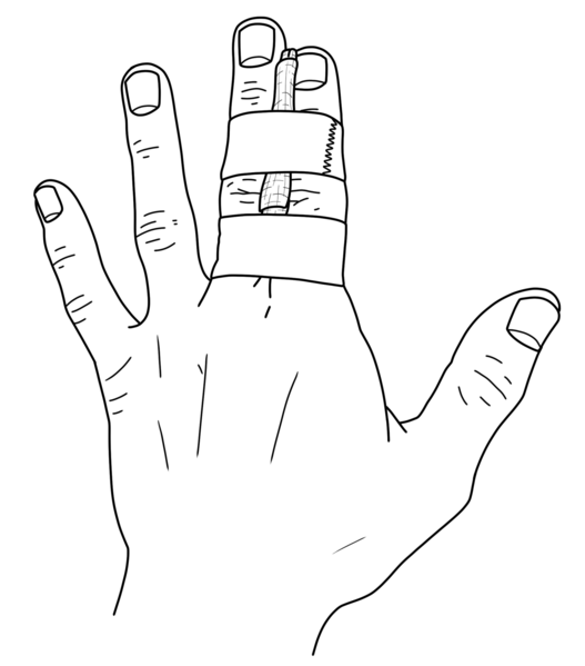 File:Buddy-taping-finger.png