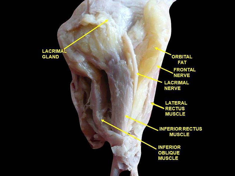 File:Slide8ababa.JPG