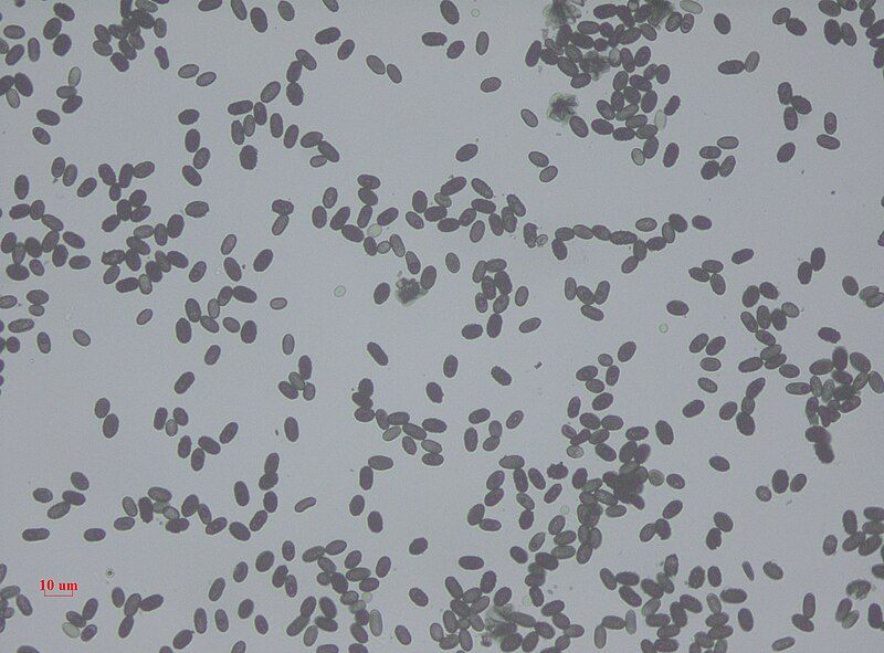 File:Stachybotrys Spores.jpg