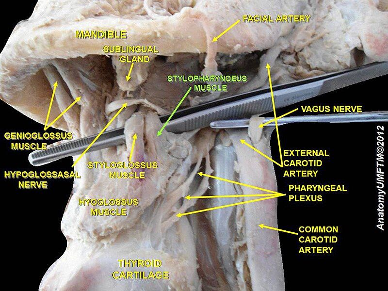 File:Slide3ggg.JPG