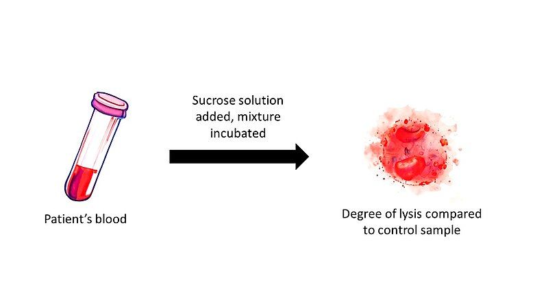 File:Sucrose lysis test.jpg