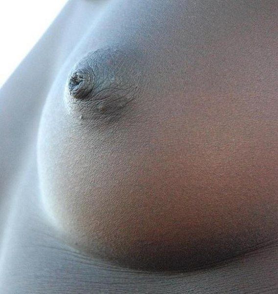 File:African Breast SG.jpg