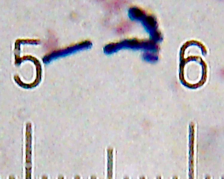 File:20101210 013757 BifidobacteriumAnimalis.jpg