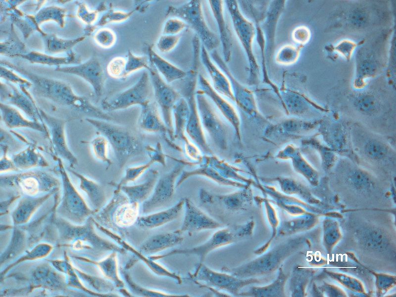 File:Cho cells adherend2.jpg