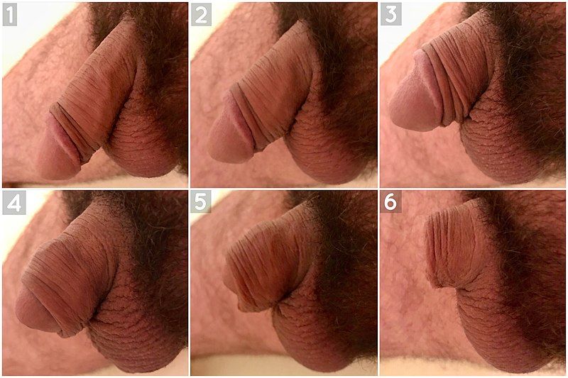 File:Flaccid Penis Shrinkage.jpg