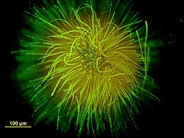 Ball-shaped colony of Gloeotrichia echinulata