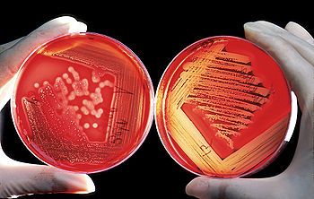 Agar plate