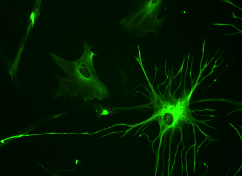 File:Human astrocyte.png