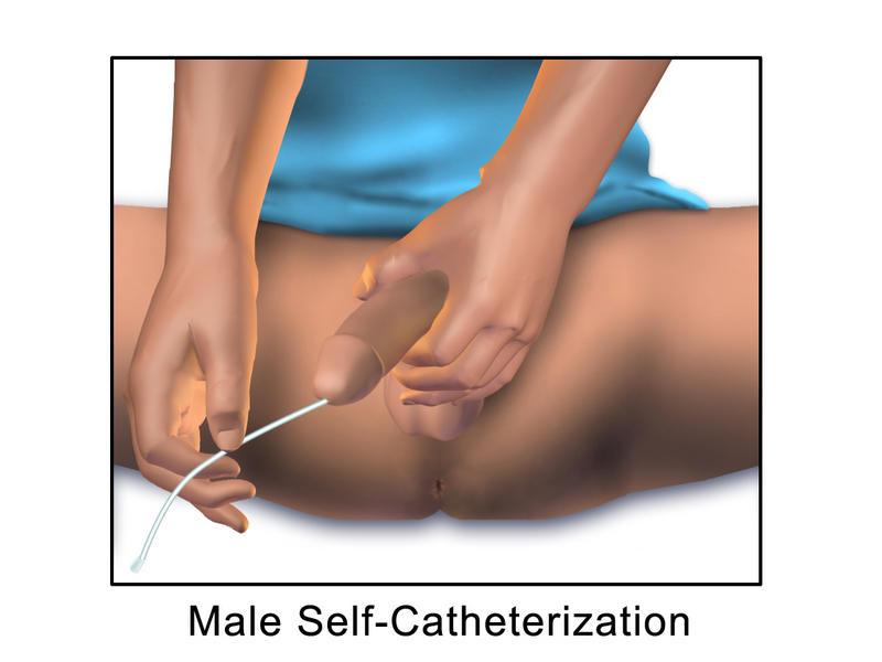 File:Male Self-Catheterization.png