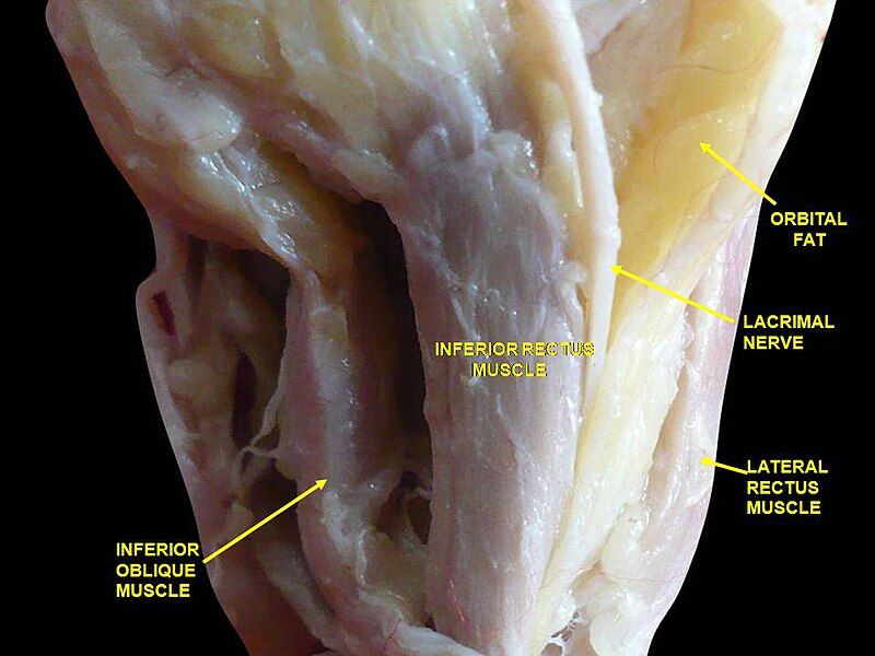 File:Slide9abab.JPG