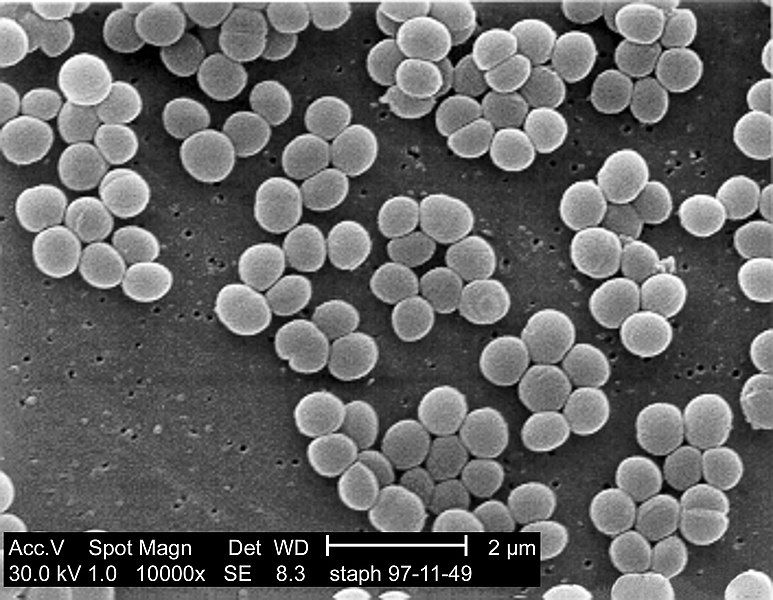 File:Staphylococcus aureus 01.jpg