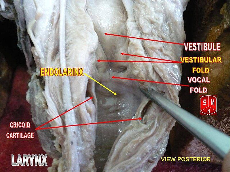 File:Epiglottis.jpg