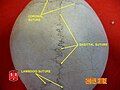 Sagittal suture.