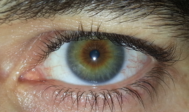 File:Hazel eye1.png