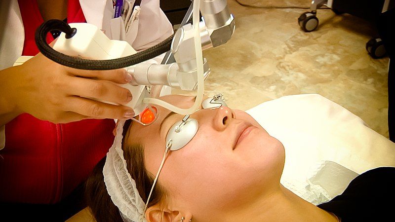 File:Co2-fractional-laser-ama-regenerative-medicine-skincare-1.jpg