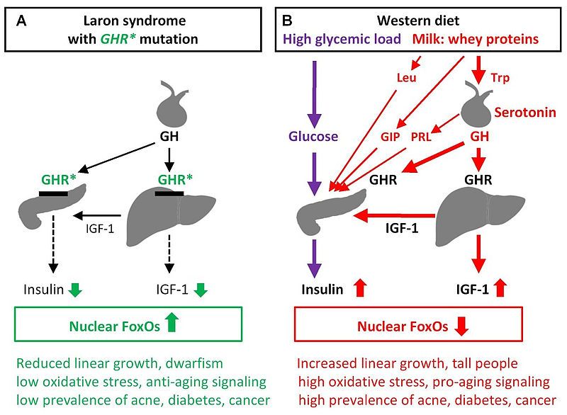 File:Laron syndrome 01.jpg