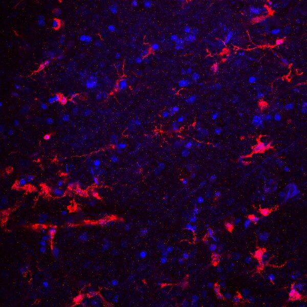 File:Microglial cells.tif