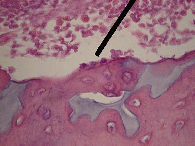 File:WVSOM Osteoblast.JPG