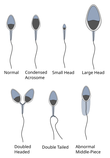 File:Abnormalsperm.svg