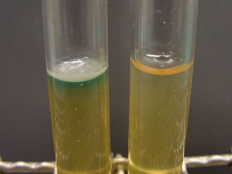 File:Pseudomonas aeruginosa pyocyanin.jpg