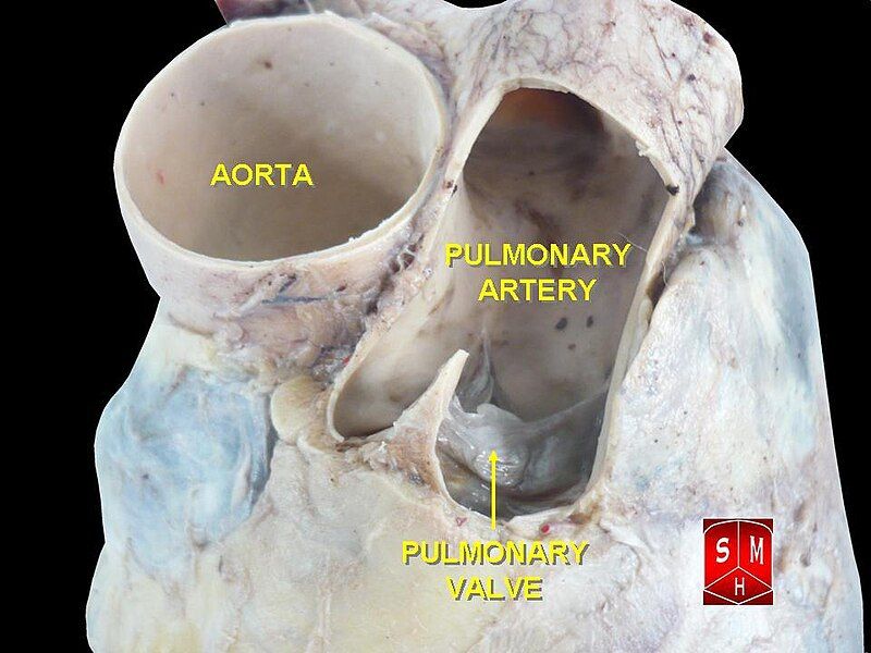 File:Pulmonary artery.jpg