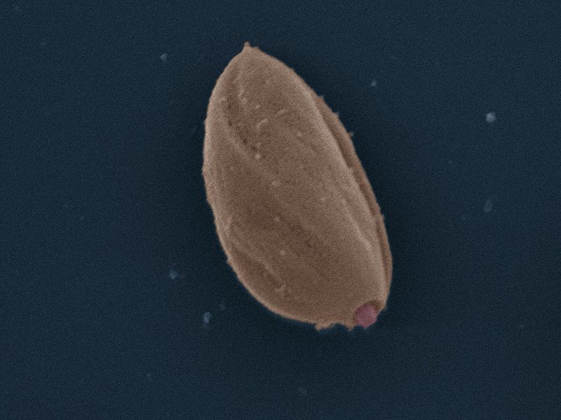 File:LeishmaniaMexicana Amastigote SEM.jpg