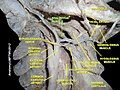 Stylohyoid muscle