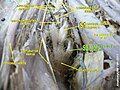 Sacral spinal nerve 2