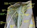 Pectineus muscle