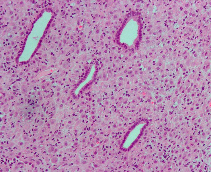 File:Endometrium ocp use2.jpg