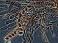 Morchella elata asci and ascospores, by Peter G Werner