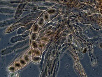 Asci and ascospores