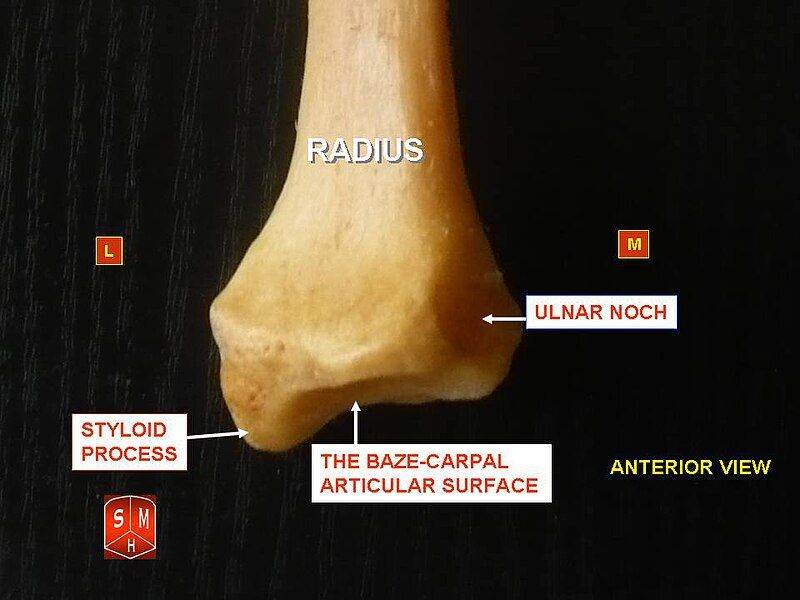 File:Radius4.jpg