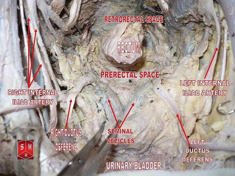 File:Seminal vesicles.jpg