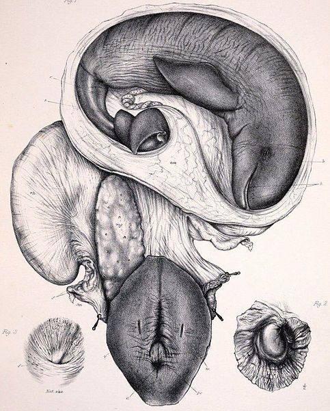 File:Orcaella foetus.jpg