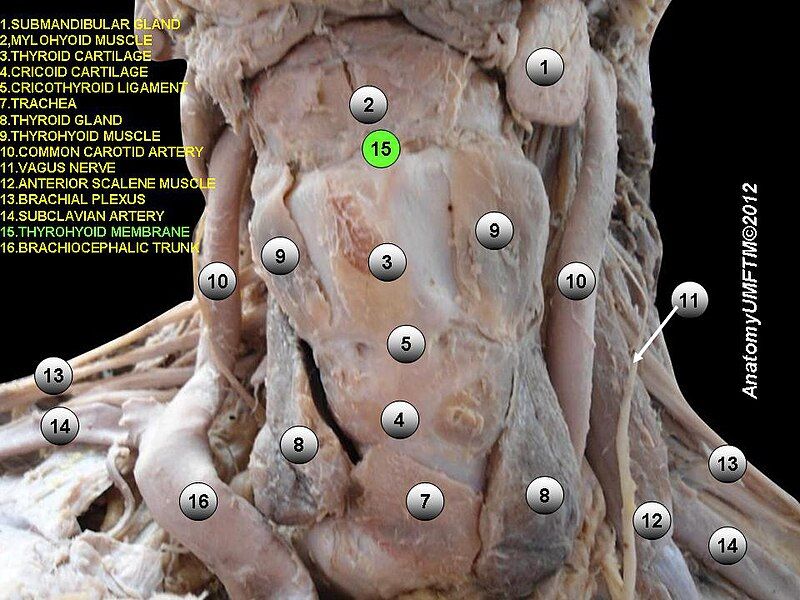 File:Slide14e.JPG