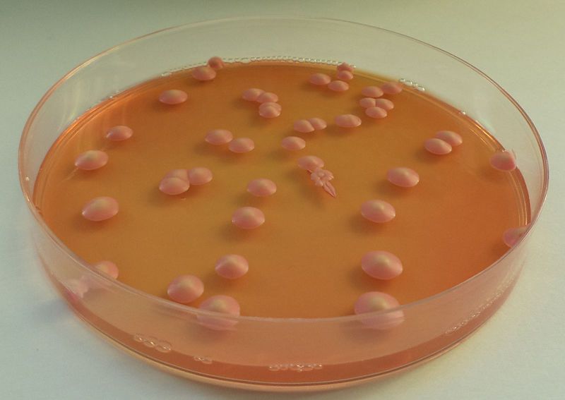 File:Brettanomyces plate 01.jpg