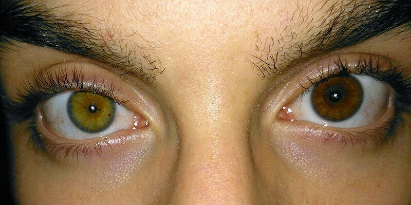 File:Complete heterochromia green-brown.jpg