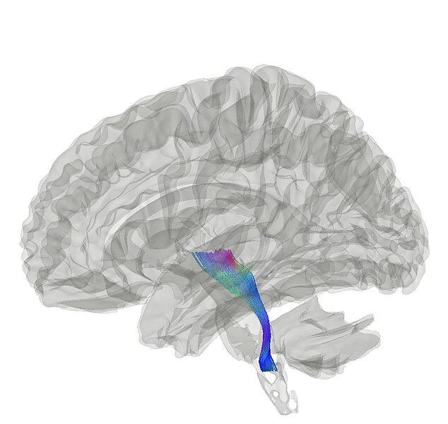 File:Medial Lemniscus.jpg