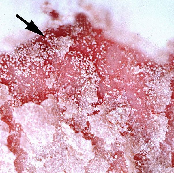 File:Psoroptes-mites-infestation-sheep-scab-closeup-2.jpg