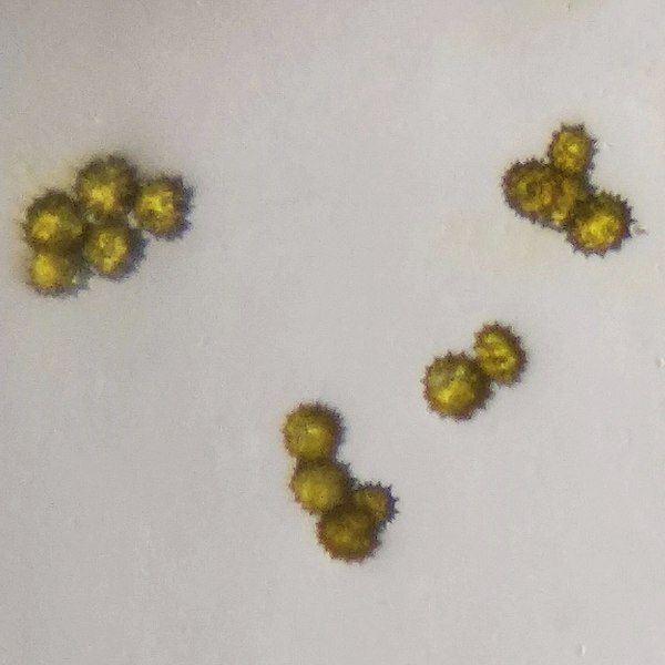 File:Pollens of Chrysanthemum.jpg