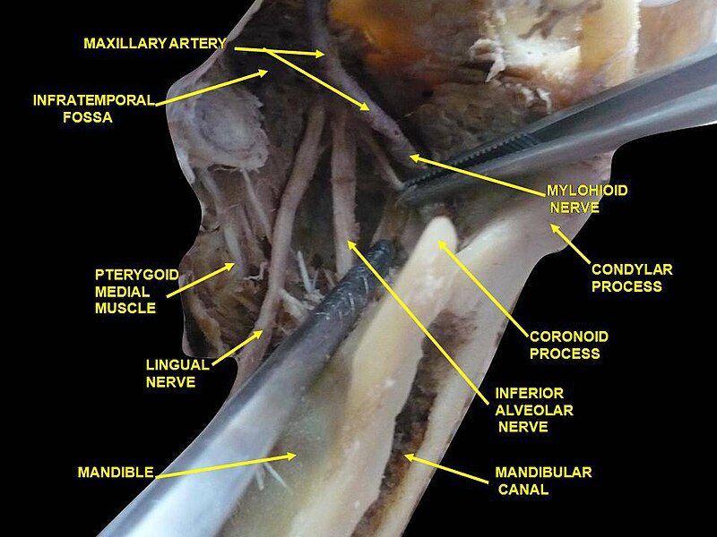 File:Slide7cece.JPG