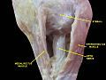 Optic nerve. Deep dissection. Inferior view.