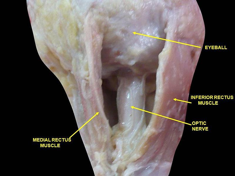 File:Slide17ior.JPG