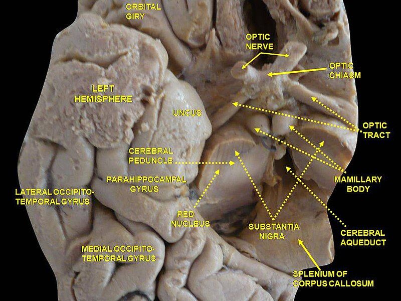 File:Slide3HOM.JPG