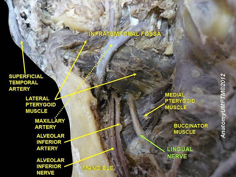 File:Slide11dddd.JPG