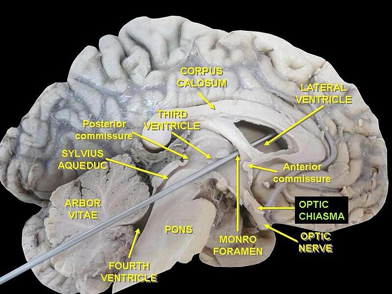 File:Slide13qq.JPG