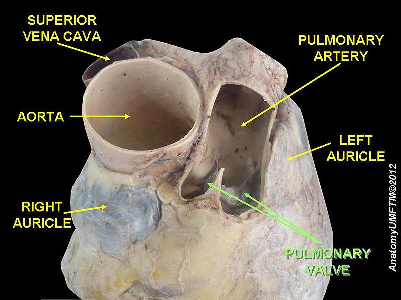 File:Slide4xxxx.JPG